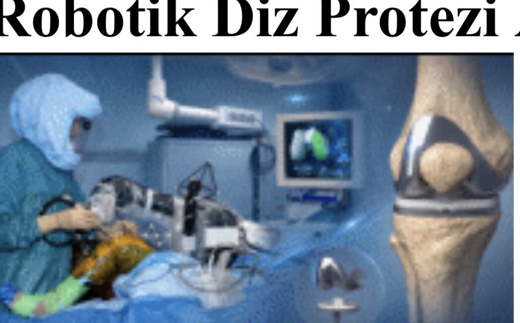 , Robotik diz protezi nedir? Robotik diz protezi, bilgisayar destekli